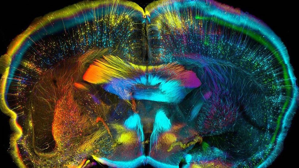 About Us Amsterdam Brain Cognition Journal